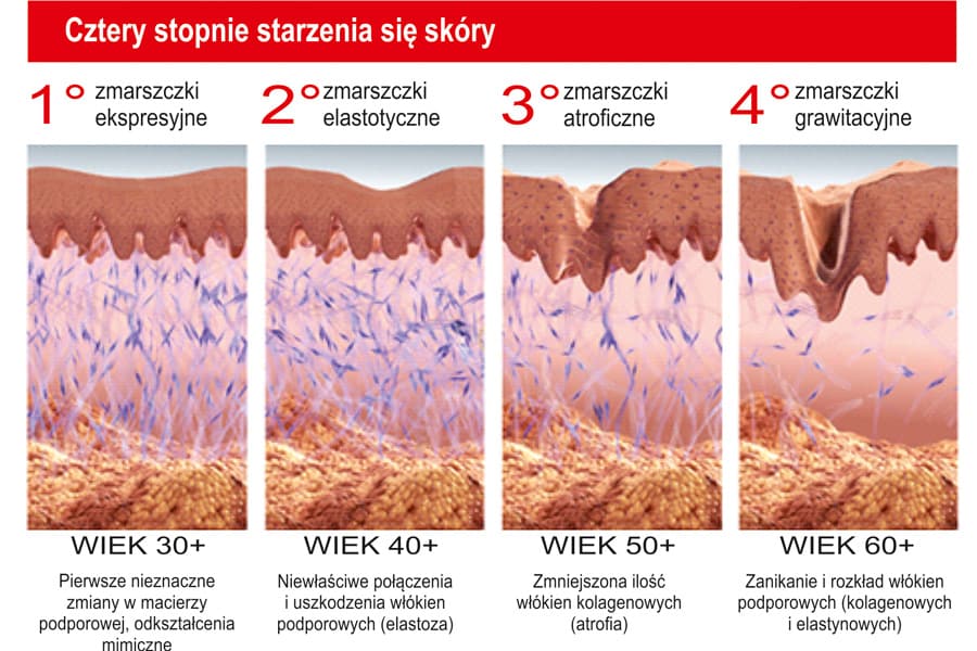 4 stopnie starzenia skóry